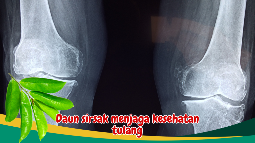 Daun sirsak menjaga kesehatan tulang