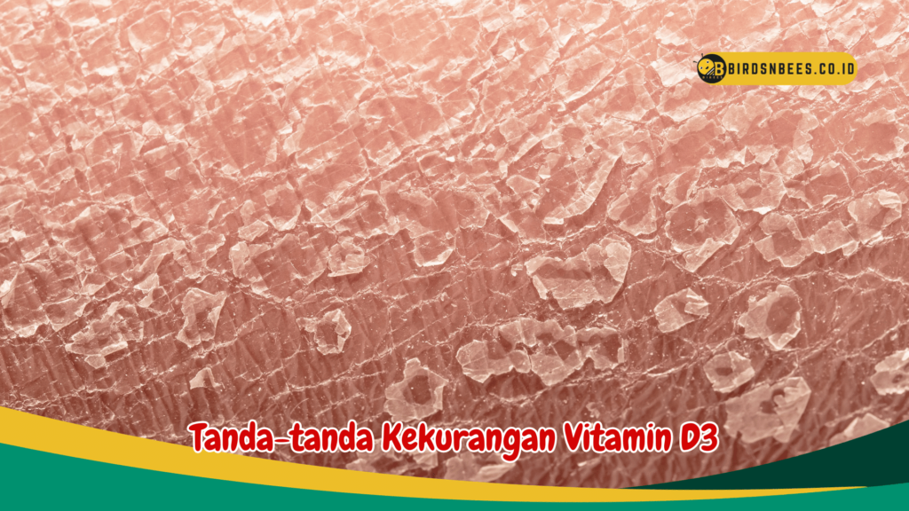 Tanda-tanda Kekurangan Vitamin D3