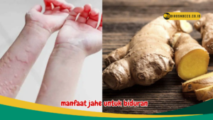 manfaat jahe untuk biduran